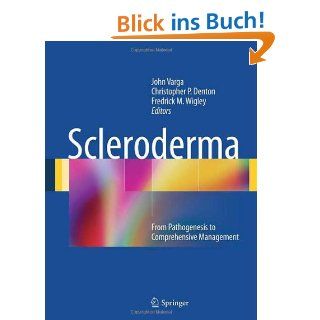 Scleroderma From Pathogenesis to Comprehensive Management 