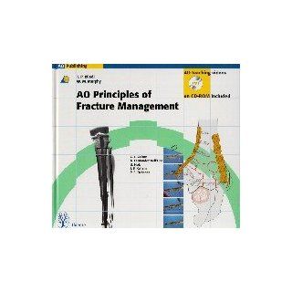 AO Principles of Fracture Management. Buch und CD ROM für Windows 95