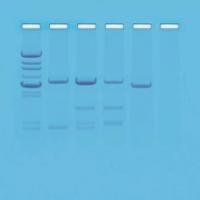 Edvotek DNA Paternity Testing Simulation Kit  